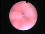 oesophagoscopy-and-gastroscopy-2