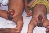 Urology